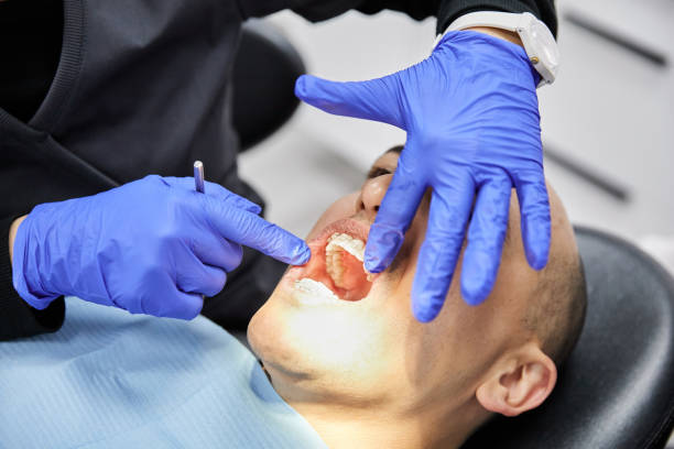 Best Emergency Denture Repair in Upper Lake, CA